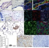 Malanchi and others 2011. Figure 2